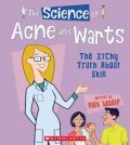 The Science of Acne and Warts. The Itchy Truth about Skin