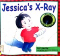 Jessica'S X-Ray Includes Actual X-Rays!